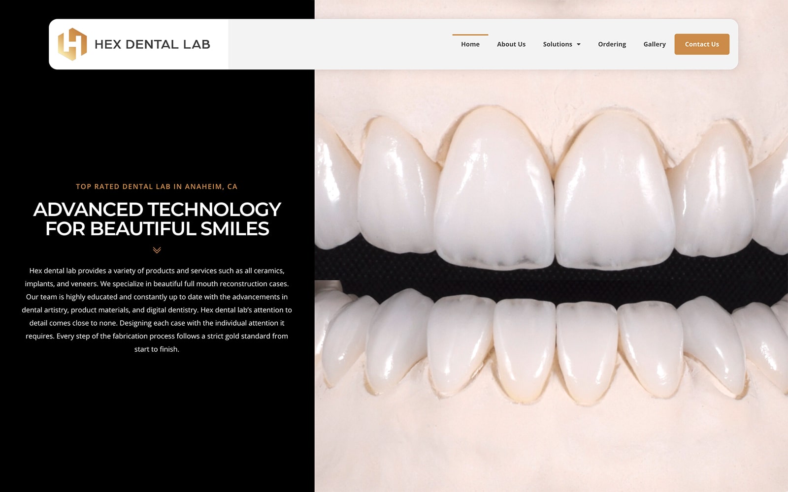 Hex Dental Lab Screenshot with Teeth